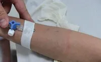 Bảo hiểm sức khỏe tuy bán tốt, nhưng nằm trong nhóm sản phẩm có tỷ lệ trục lợi cao nhất